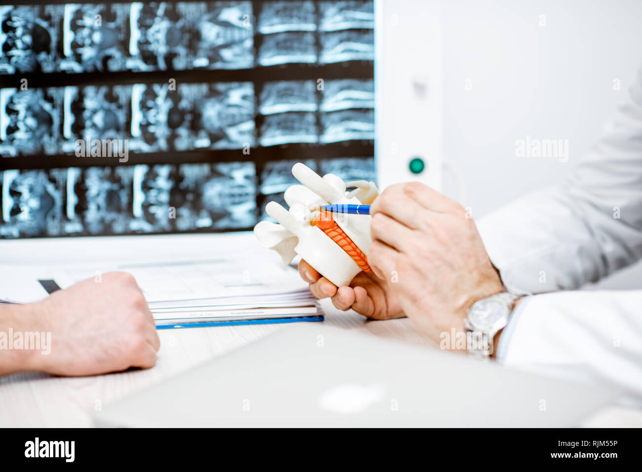 Close-up del terapista azienda modello anatomico di vertebre con ernia intervertebrale Foto Stock