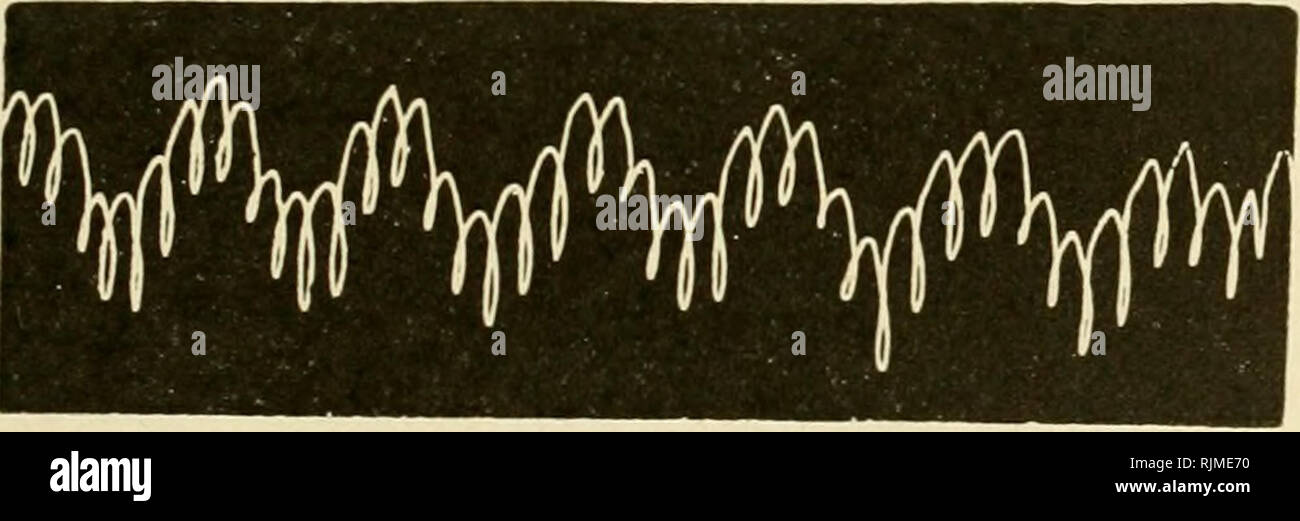 . Pressione barometrica : ricerche in fisiologia sperimentale. Pressione atmosferica; fisiologia, confronto; Anoxemia; altitudine, influenza del. Aria compressa; basse pressioni 773 essere presi sono a ventilare la campana correttamente prima di inserire il tappo, per eseguire una registrazione solo quando l'animale è molto calma e per aria compressa, al fine di evitare variazioni di pressione durante la registrazione. Esperimento CCCXXXIV. Febbraio 12. Un gatto è posto sotto la campana. A pressione normale dà il tracciato in figura 67. Dobbiamo tenerne il cilindro di compressione e in circa un ora di raggiungere una compressione di +53 cm. (Tot Foto Stock