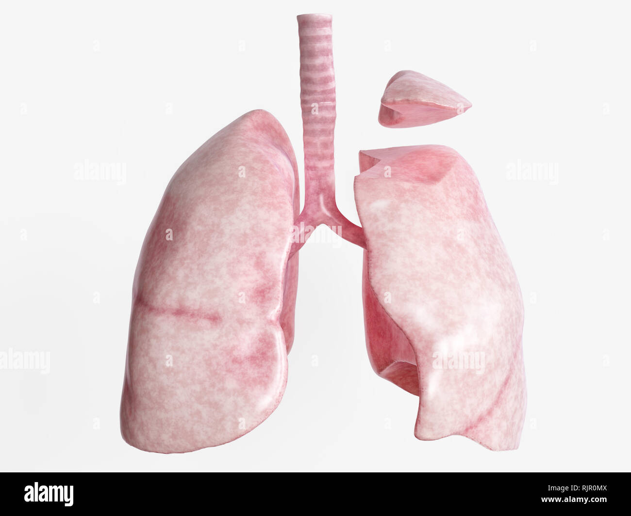 La resezione segmentale dopo una grave malattia polmonare - 2 di 4 - 3D Rendering Foto Stock