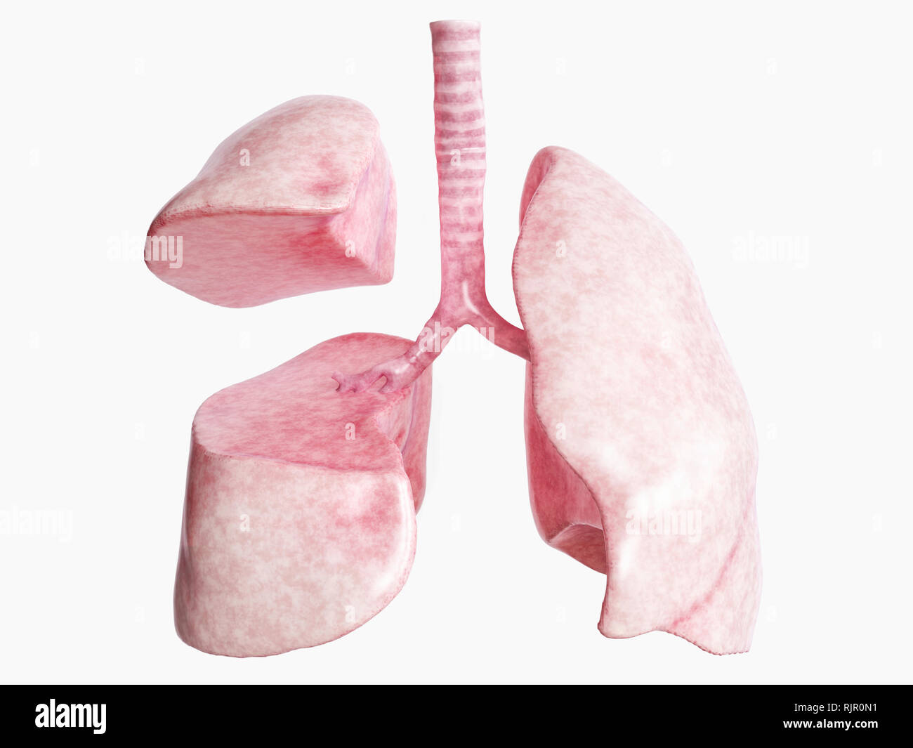 Lobectomie dopo una grave malattia polmonare - 3 di 4 - 3D Rendering Foto Stock