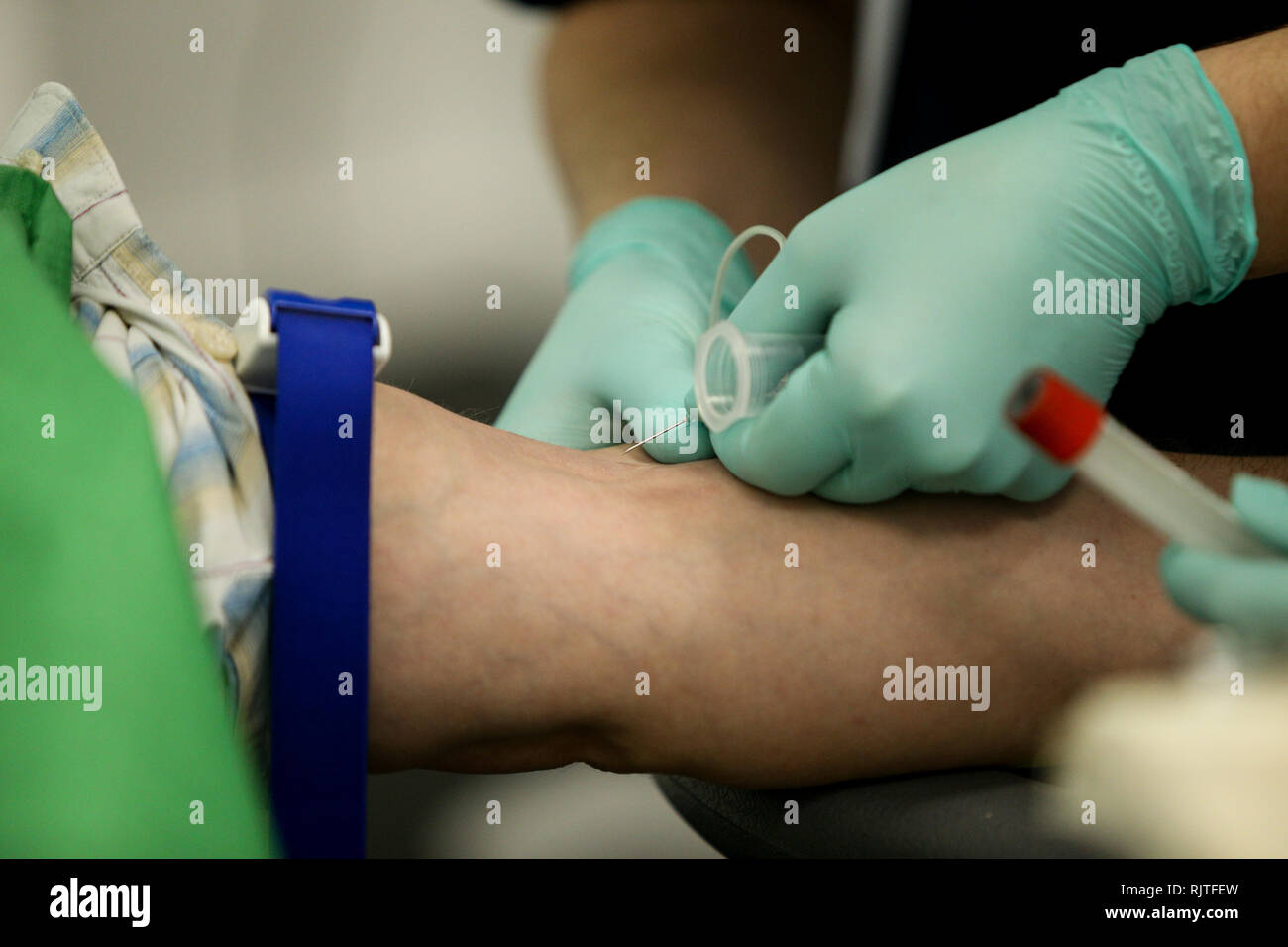 Dettagli con le mani di un medico, gomma da indossare i guanti chirurgici, preparandosi a prendere il sangue dalla vena di un paziente con un catetere Foto Stock