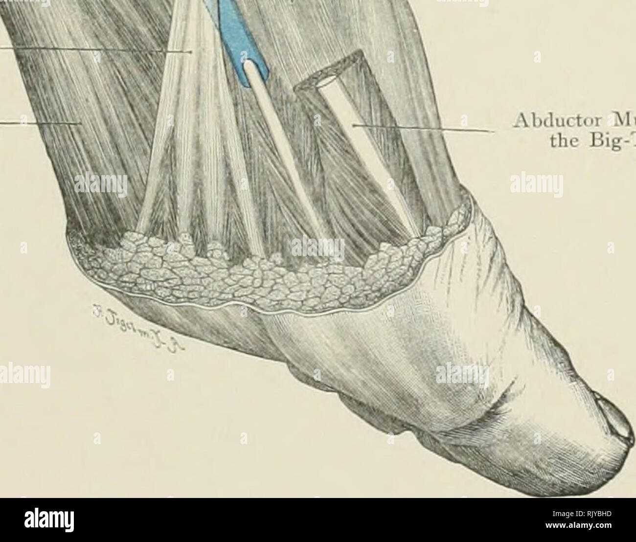 . Atlas di applicato (carta topografica) anatomia umana per studenti e professionisti. Anatomia. - -I- malleolo interno - laterale interna luberclc legamento di osso scafoide Abductor muscolo della Big-Toe. Fig. 189. Guaine tendinee dietro il malleolo interno. '/, Nat. 8ize. llebman Liiniled, Loiiiluu. RebiiiMii Comiiany, New York. Si prega di notare che queste immagini vengono estratte dalla pagina sottoposta a scansione di immagini che possono essere state migliorate digitalmente per la leggibilità - Colorazione e aspetto di queste illustrazioni potrebbero non perfettamente assomigliano al lavoro originale. Bardeleben, Karl Heinrich von, 1849-1919; Haecke Foto Stock