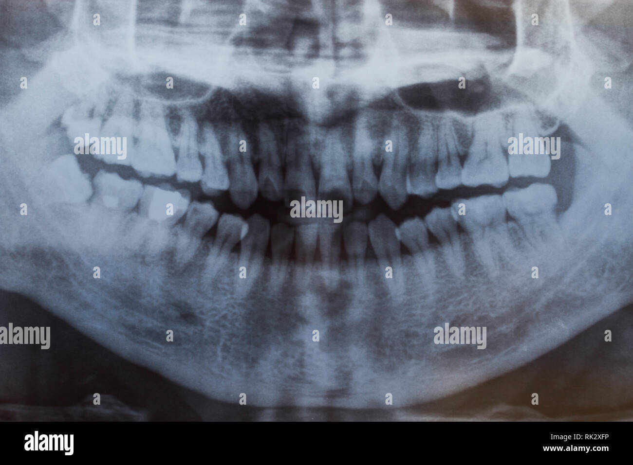 Foto prospettica dei denti umani Foto Stock