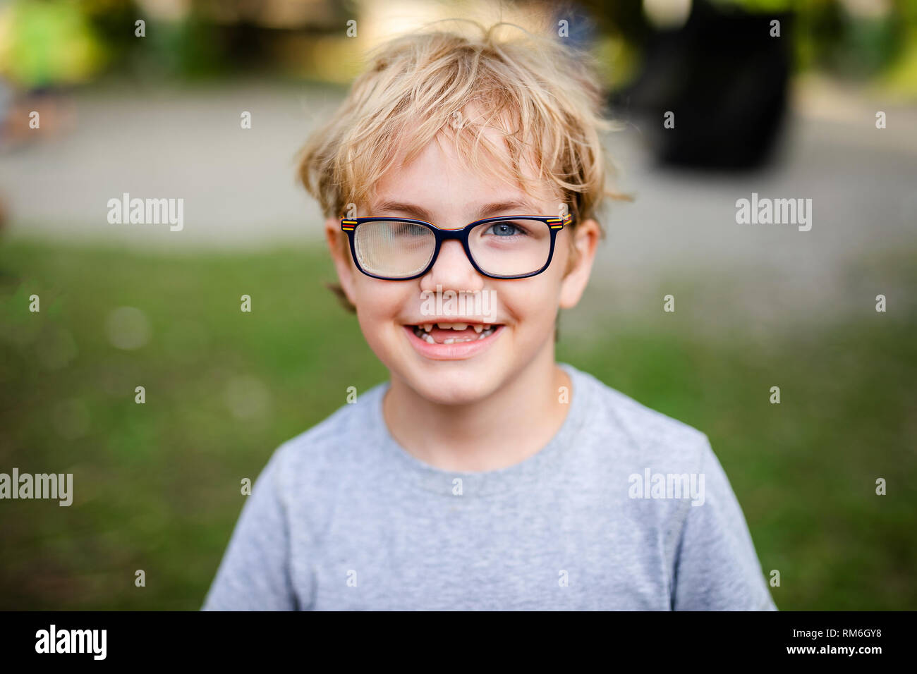 Bionda sorridente ragazzo con lo strabismo indossando occhiali con lenti  speciali nel parco di caldo Foto stock - Alamy