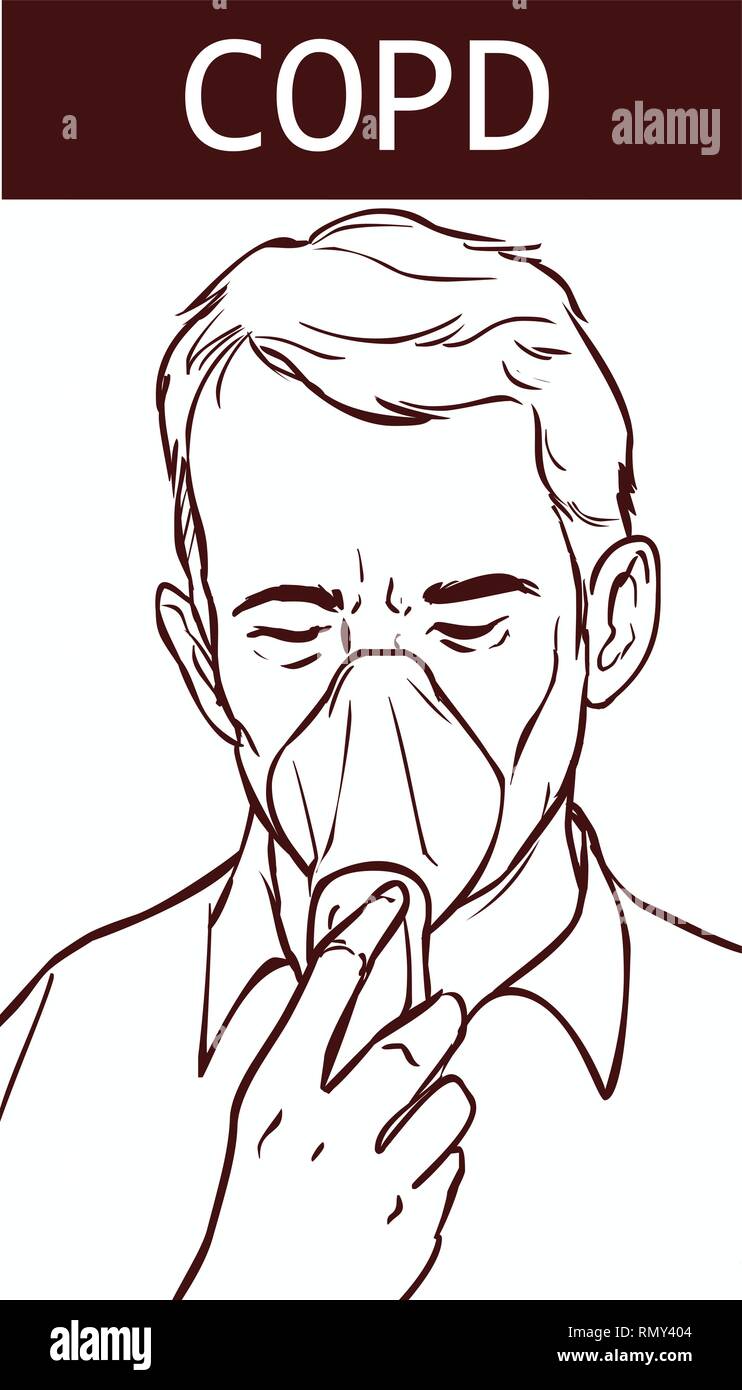 La malattia polmonare ostruttiva cronica (COPD) Illustrazione Vettoriale