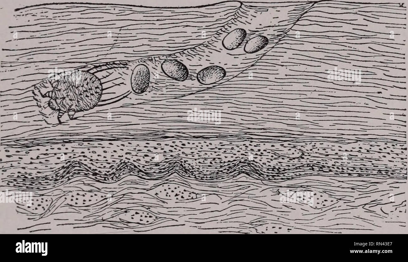 . Parassiti animali e malattia umana. Insetti vettori; parassiti; malattie parassitarie; medico di parassitologia; insetti come vettori della malattia. Acari della scabbia -Vita storia 343 acaro, ma molti di essi possono essere trasferiti facilmente da un host a un altro. Nel comune di specie umana il maschio è solo di circa 0,25 mm. (T^ di un pollice) di lunghezza, mentre la femmina è di circa 0,4 mm. (^V di un pollice) di lunghezza. Una varietà di questo acaro, S. scabiei crustosce, causando il cosiddetto " prurito norvegese", si trova nel nord Europa e di tanto in tanto negli Stati Uniti, ma è sempre rare. La malattia causata da esso Foto Stock