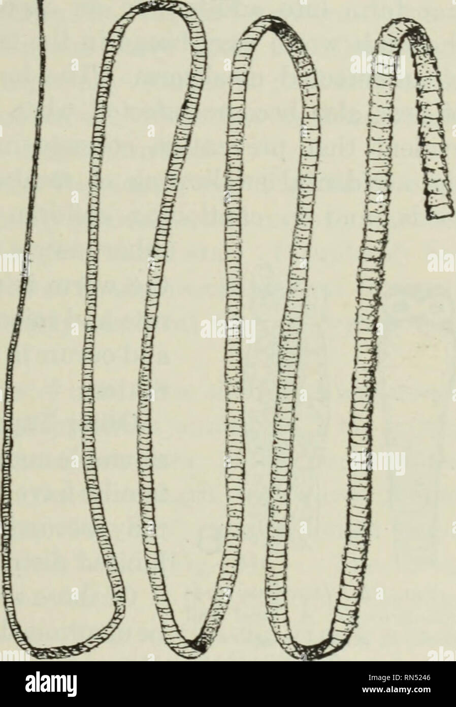 . Parassiti animali e malattia umana. Parassiti; medico di parassitologia; insetti come vettori della malattia. La tenia NANA 243 dalle armate di testa, e diventato adulto. Si è detto che le uova di questo parassita può essere trovato nelle feci entro un mese dopo un uovo della generazione precedente sono state inghiottite. Self- Infezione con queste uova si verifica raramente, dato che le uova non si svilupperà a meno che non sia sollecitato dai succhi gastrici. Vi è ancora spazio per il dubbio di un insetto non è comunemente coinvolti come un ospite intermedio come in altre specie di Hymenolepis; infatti, molti ricercatori hanno trovato Foto Stock