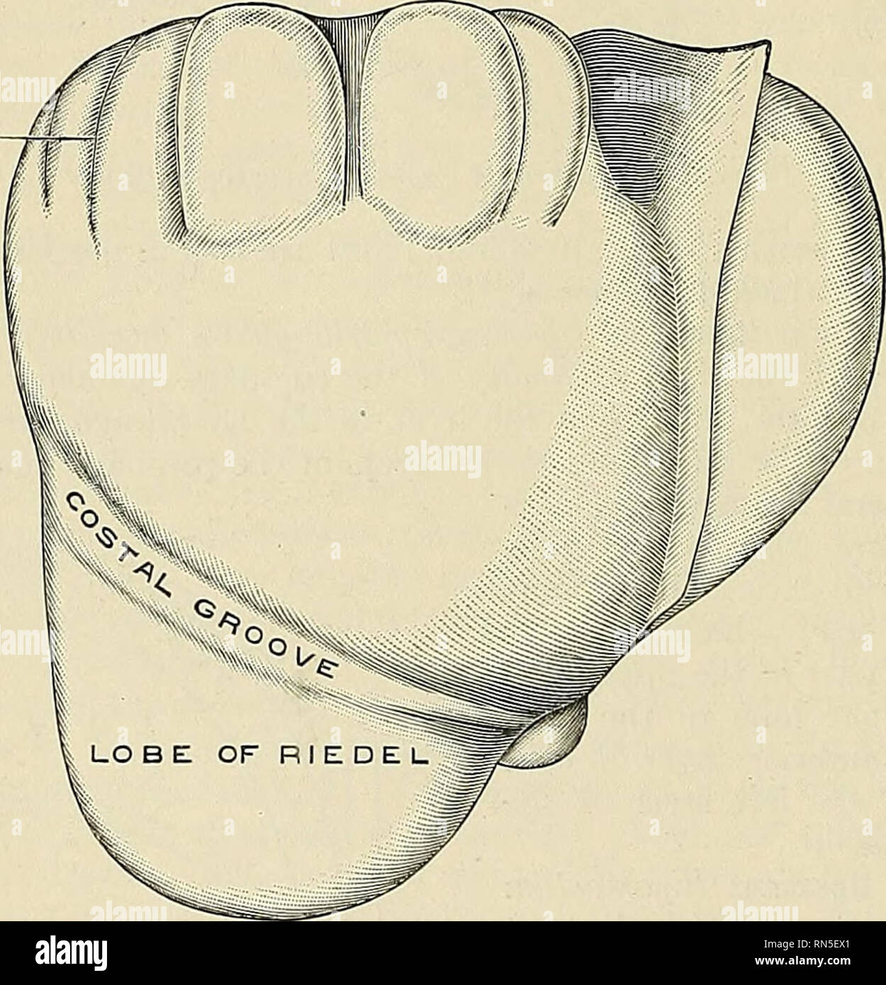 . Anatomia, descrittivo e applicata. Anatomia. 1326 gli organi della digestione le anormalità del fegato.-Il fegato può essere suddiviso in molti lobuli, e tale lobu- lazione è più evidente sulla superficie parietale del lobo destro. Lobulation è probabilmente un pato- cambiamento logica. Di tanto in tanto il lobo destro è piccolo e il grande di sinistra. I fegati di accessori sono frammenti di tessuto epatico o vestigia, che sono completamente separati dal fegato. Essi sono raramente incontrato. Quando non esiste la loro situazione più comune è il legamento sospensivo, ma sono stati trovati nel grande omento, in per Foto Stock