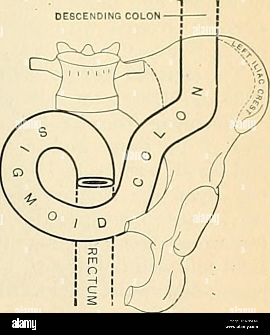 . Anatomia, descrittivo e applicata. Anatomia. Il colon ] :105 colon discendente fine della milza; dalla sua superficie sotto, con i piccoli intestini; dalla sua superficie anteriore, con gli strati anteriore del grande omento e il parietes addominale; la sua superficie posteriore sul lato destro è in relazione con la seconda porzione del duo- denum, e sul lato sinistro è in contatto con alcuni con'oIutions del digiuno e ileo. La flessura splenica è in relazione con la estremità inferiore della milza e la coda del pancreas. Si trova a un livello superiore e su un piano posteriore a, Foto Stock