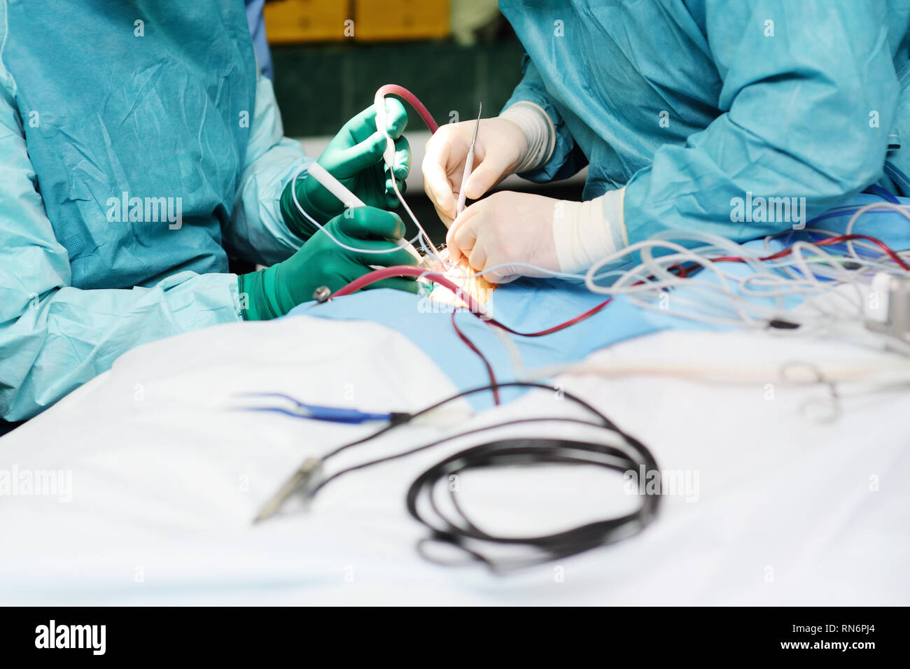 Neurochirurgia eseguire chirurgia per le accise un tumore cerebrale Foto Stock