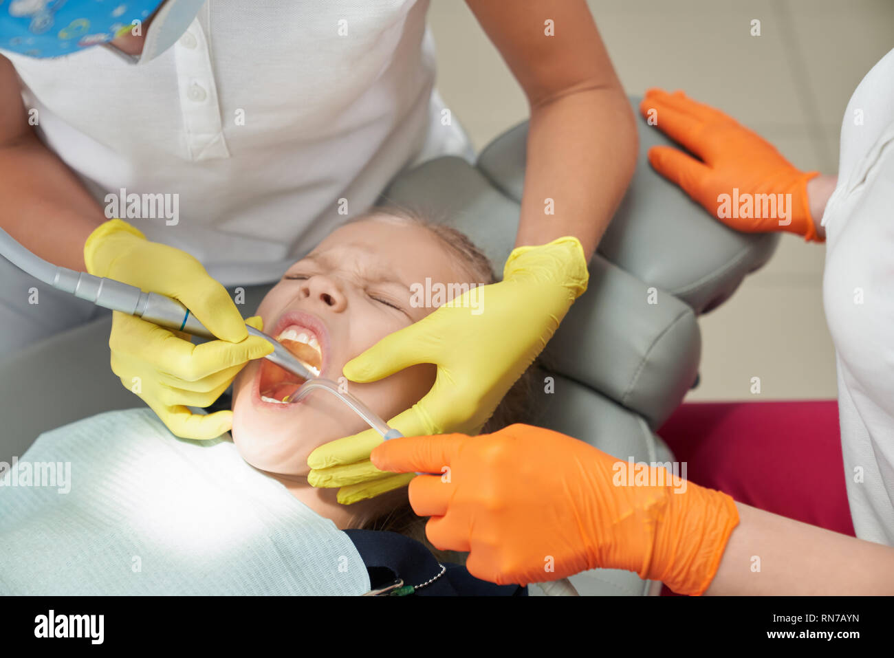 Bambino giacente sul riunito dentale con bocca aperta durante la procedura dolorosa in studio dentistico. Medici di sesso femminile il trattamento di denti e rimozione di carie del paziente. Concetto di odontoiatria e la paura. Foto Stock