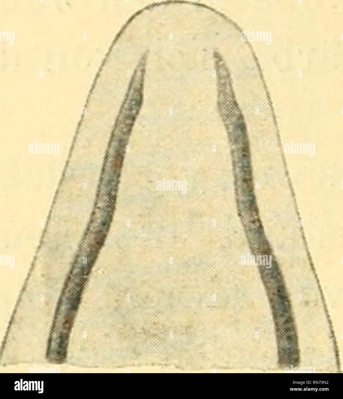 . Anatomischer Anzeiger. Anatomia, comparativo, Anatomia, comparativo. 332 sehr stark; in noch höherem masse es ist die zweite Krümmung, uomo welche richtiger Knickung nennen sollte, da ihr medialer ee einen spitzen Winkel bildet. Diese zweite Krümmung liegt nicht mehr in der Horizontalebene des Unterkiefers, sondern in einer frontale zwischen- und Sagittalebene liegenden Fläche. Darauf komme ich noch beim nächsten Stadium zurück. Die dritte Krümmung ebenso ist stark Wie die zweite, besitzt aber eine regelmäßige Bogenform. Embrione von 10 mm Kopflänge (Anat. Anz. Abb. 5 und 6). Die MECKEL'schen Kno Foto Stock