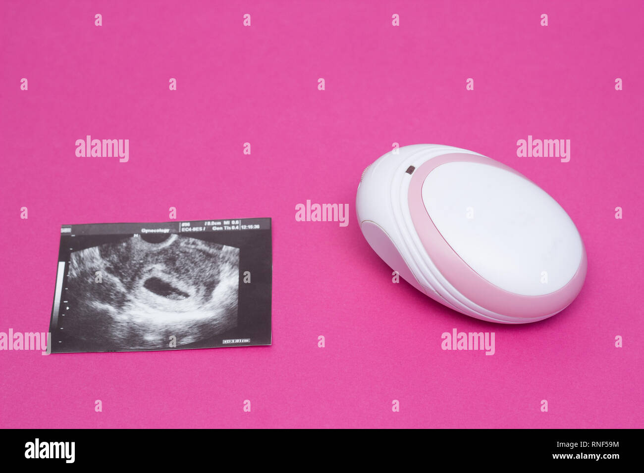 Fetal Doppler per ascoltare in una donna in stato di gravidanza il battito  del cuore di
