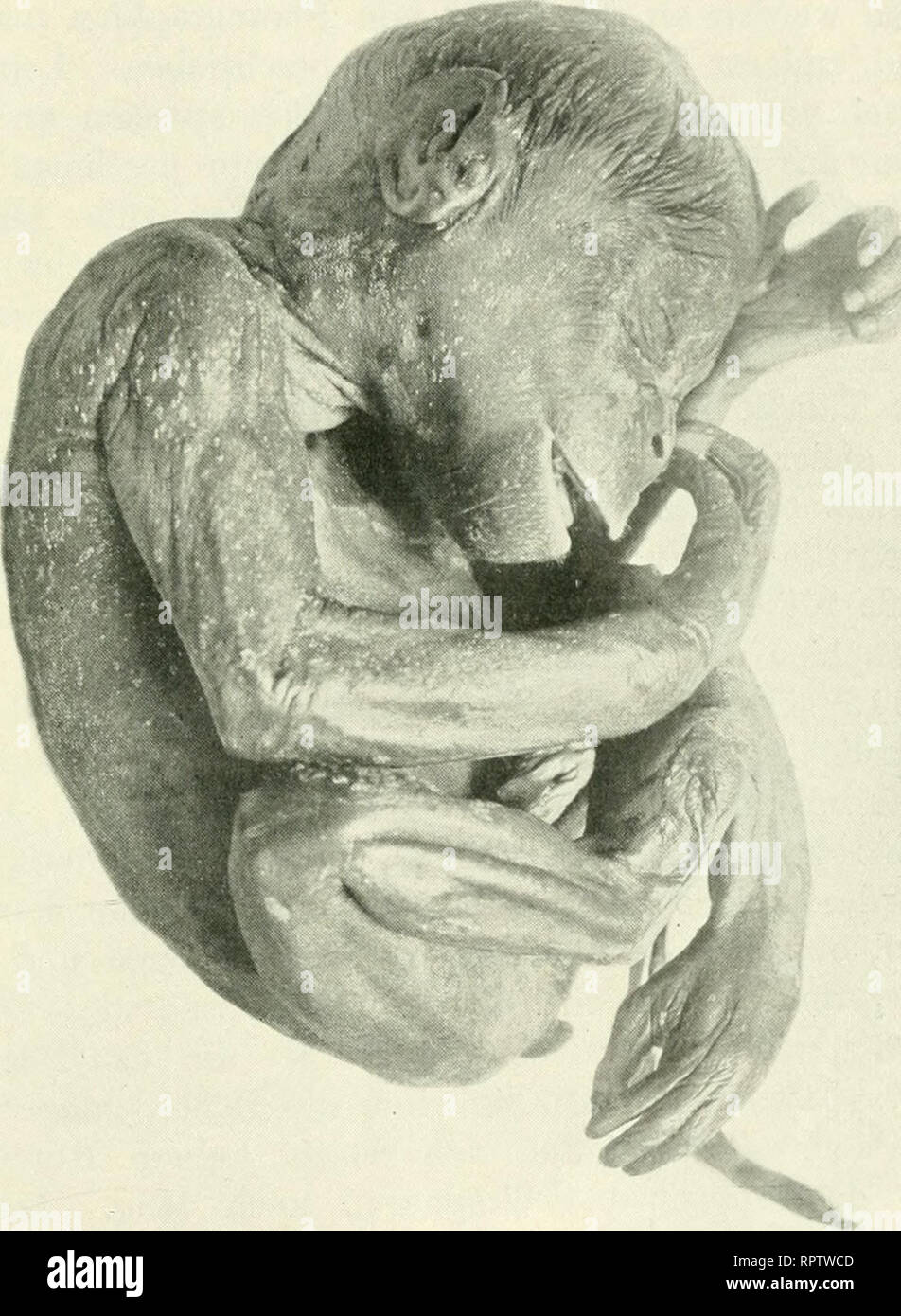 . Allgemeine und spezielle Physiologie des Menschenwachstums, für Anthropologen, Physiologen, Anatomen und Ärzte dargestellt. La crescita. Das Längenwachstum des menschlichen Säughngs. 147 lieh zu erkennen. Die Sichtbarkeit des roten Lippensauines ist bei beiden Föten ausgesprochen stärker als beim Papuafötus (abb. 17). Es ist nicht richtig, dass Nur der Mensch Lippenrot zeigen soll im Gegen- satz zu allen anderen Tieren, wohl aber kann man sagen, dass beim Menschen das Lippenrot eine höhere Entwicklungsstufe und höhere un-. Abb. 33. Tschegofötus. passung an die Säugefunktion erreicht als bei allen una Foto Stock
