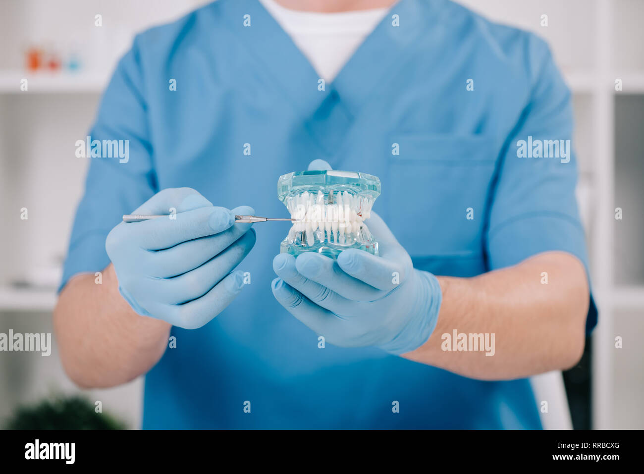 Vista ritagliata di ortodontista azienda modello a ganascia in clinica Foto Stock