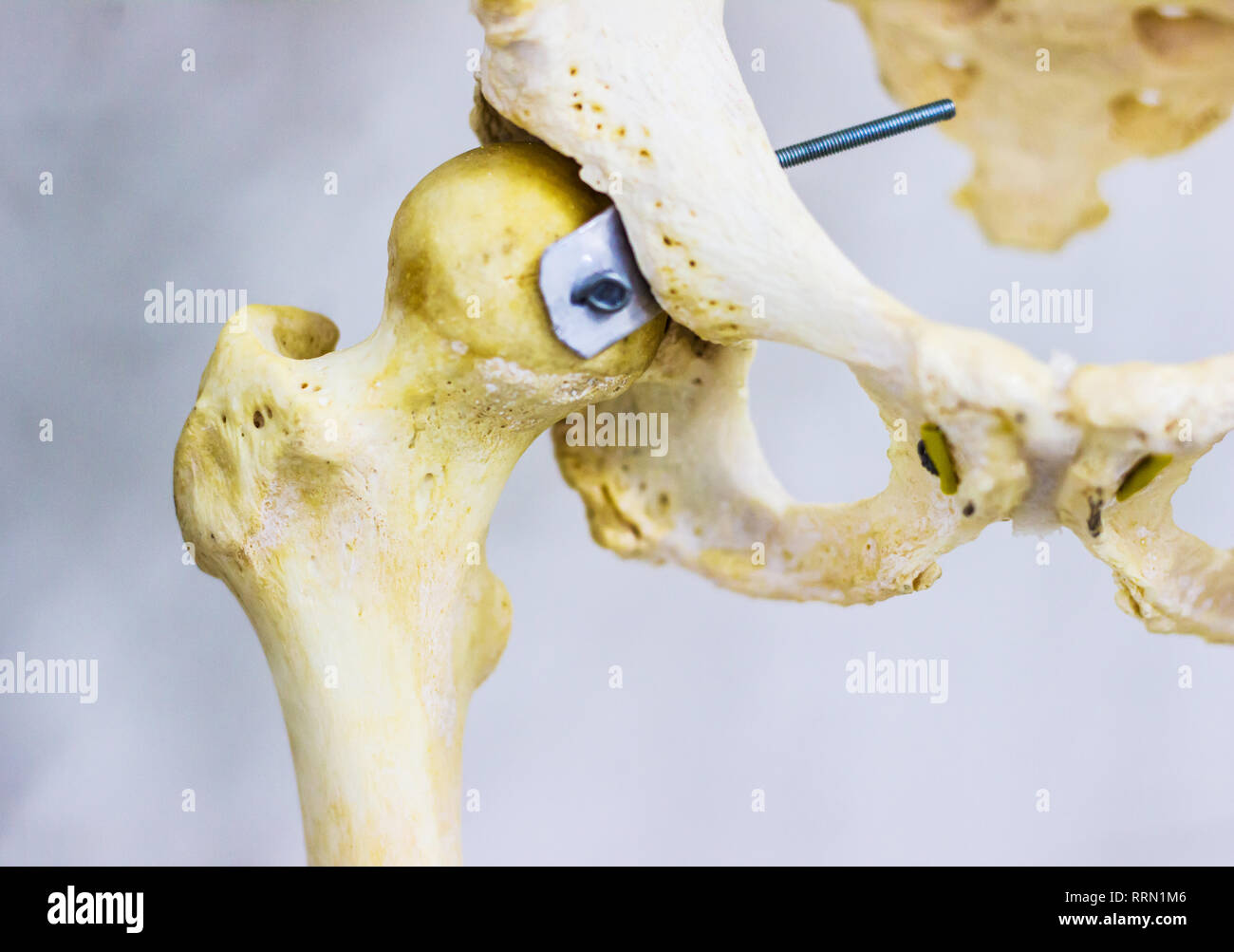 Articolato di osso dell'anca e della testa del femore umano mostra Anca anatomia in sfondo bianco Foto Stock