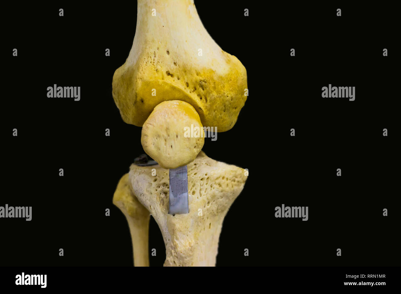 Antero vista posteriore del femore articolato tibia perone rotula che mostra le ossa articolazione di ginocchio umano anatomia in isolati su sfondo nero con spazio per tex Foto Stock