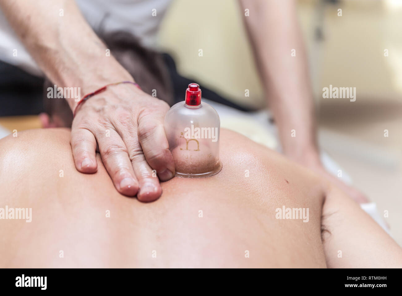 Fisioterapista facendo Terapia cupping a un giovane paziente di sesso maschile Foto Stock