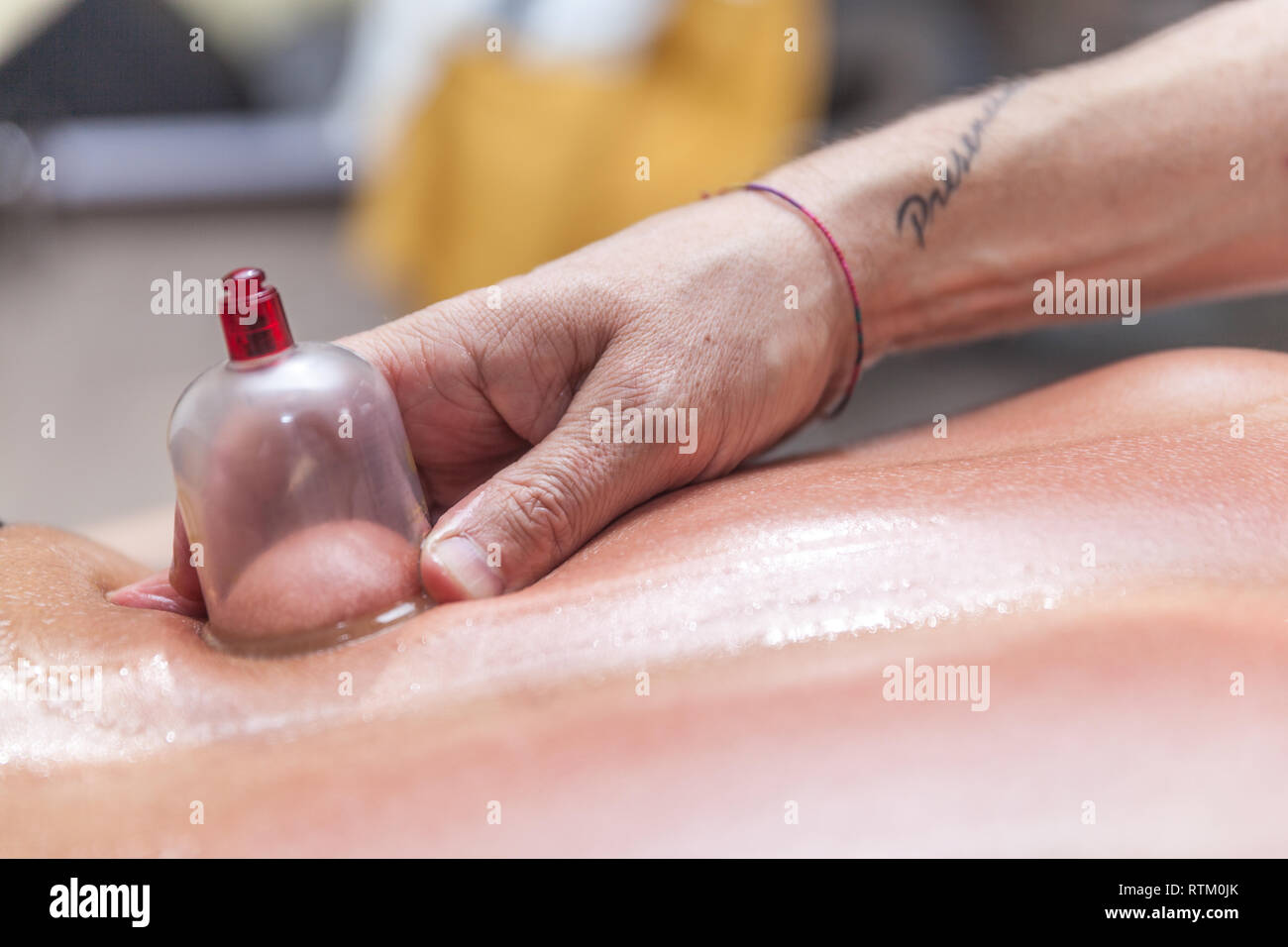 Fisioterapista facendo Terapia cupping a un giovane paziente di sesso maschile Foto Stock