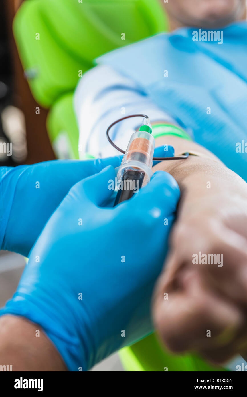 Il prelievo di sangue per il plasma ricco di piastrine (PRP) di trattamento. Medico il prelievo di sangue per un PRP trattamento cosmetico. Foto Stock