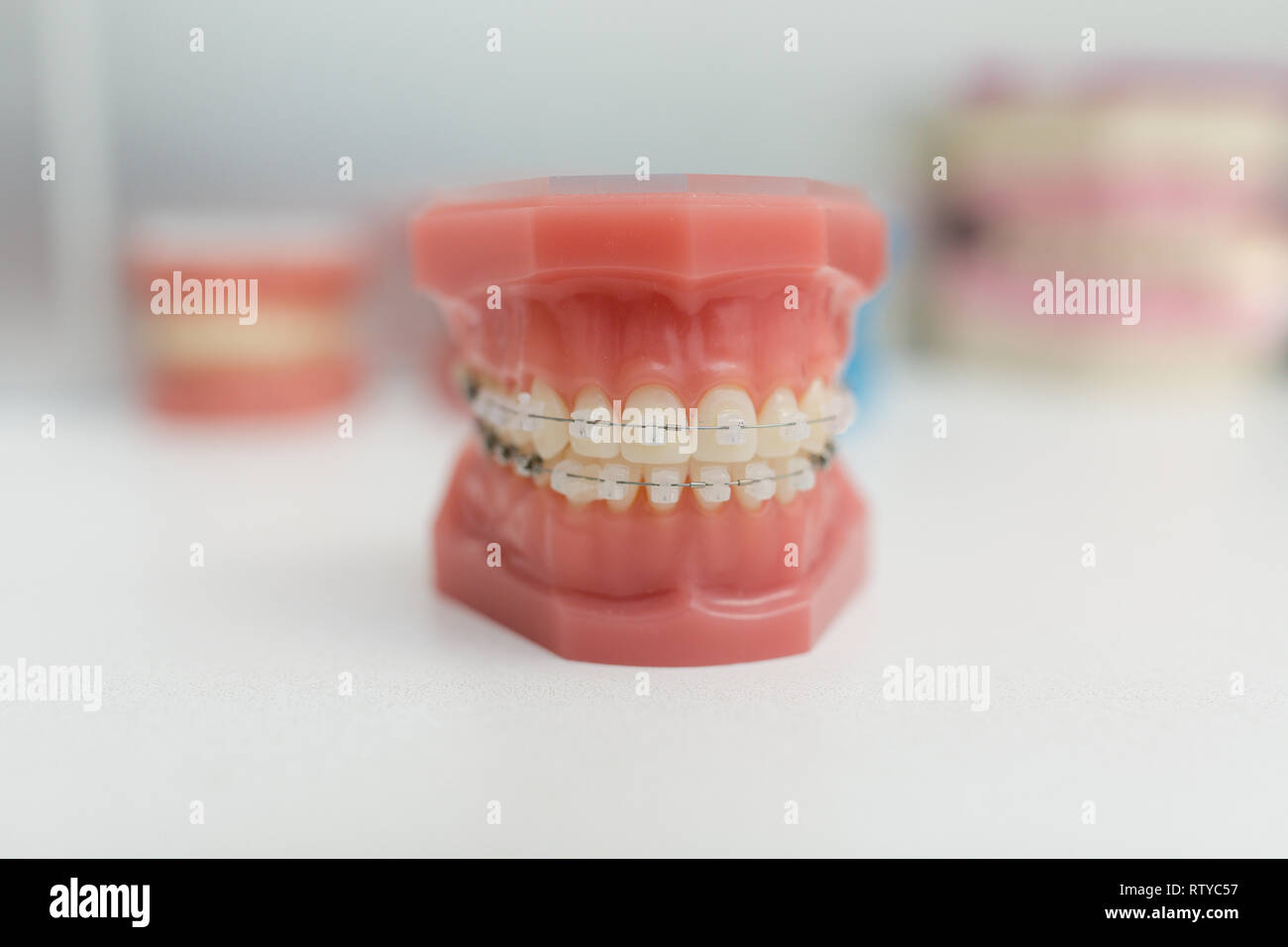 Modello ortodontico - Denti bianchi con bretelle. Mascella umana. Modelli di odontoiatria. Foto Stock