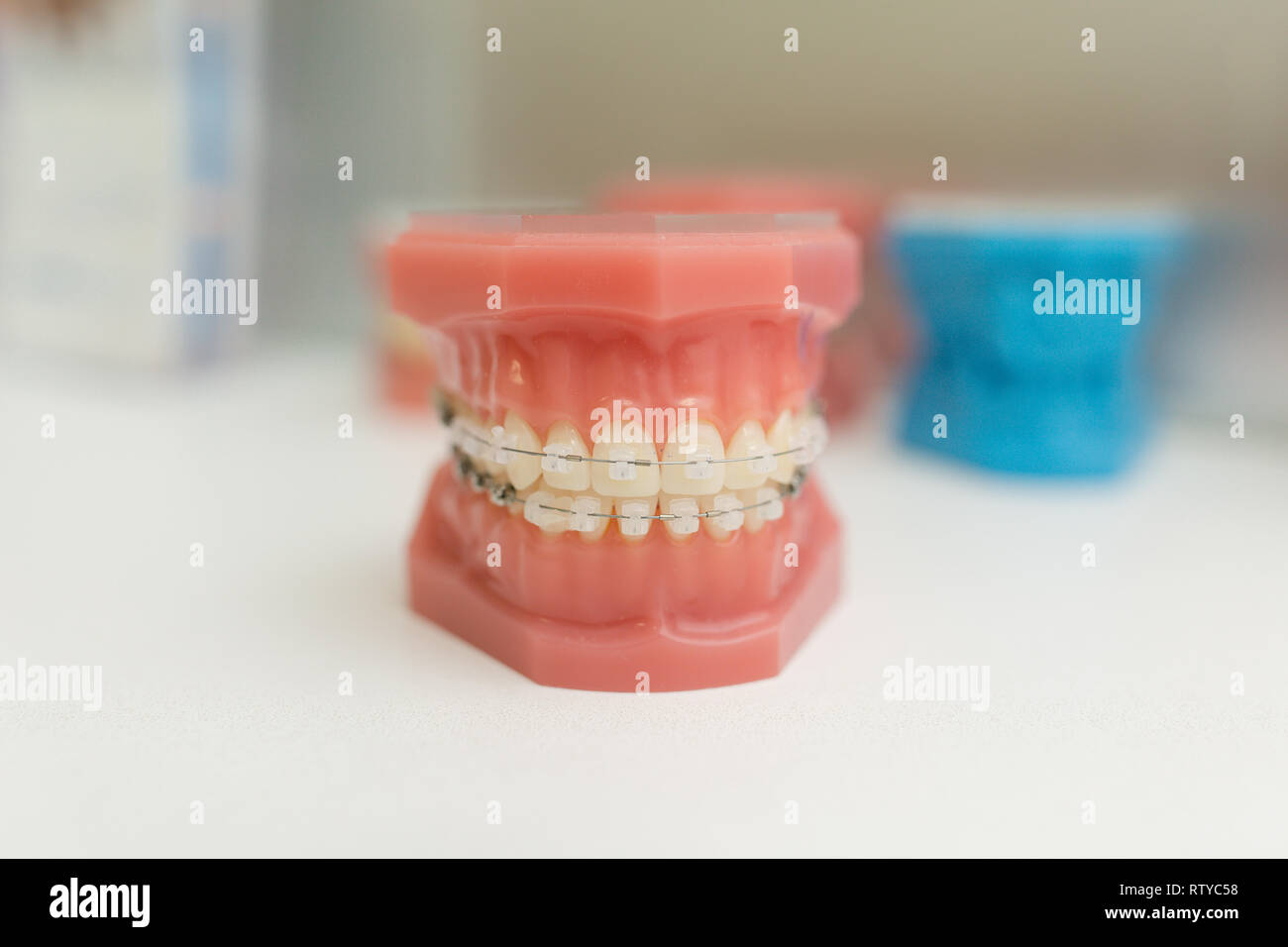 Modello ortodontico - Denti bianchi con bretelle. Mascella umana. Modelli di odontoiatria. Foto Stock
