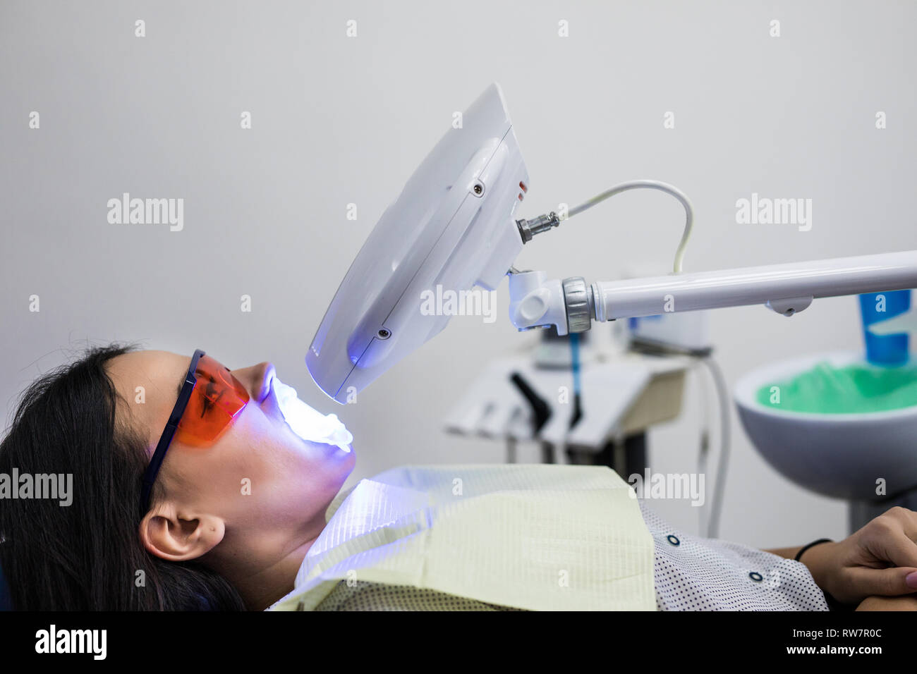 Lo sbiancamento dei denti luce ultravioleta. La ragazza alla reception presso il dentista per lo sbiancamento dei denti. Il concetto di cura dentale. Foto Stock