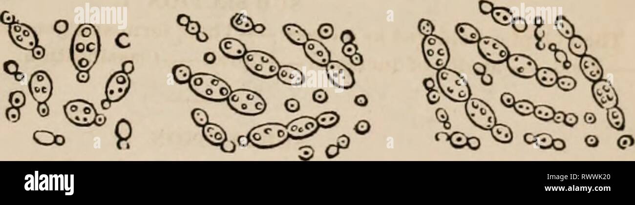 Elementi di zoölogy un elementi di zoölogy : un libro di testo elementsofzolo00tenn Anno: c1875 lievito-impianto (Torula cerevisire) come si sviluppa durante la fermentazione, a, 6, c, d, e successive fasi di moltiplicazione cellulare. e in molti casi anche meno complicato nella loro struttura di questa piccola pianta che chiamiamo lievito, essendo solo particelle di muco-come la materia (sarcode o protoplasma). Foto Stock
