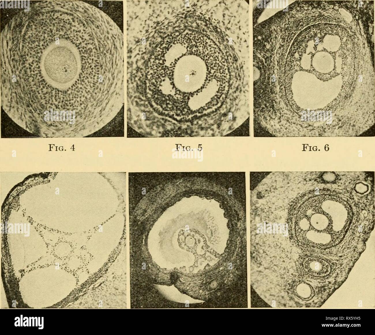 Le uova dei mammiferi (1936) Le uova dei mammiferi eggsofmammals00pinc Anno: 1936 Fig. 1 La Fig. 2 La Fig. 3 La Fig. 7 La Fig. 8 Fig. 9 Piastra III. Lo sviluppo del folhcle e ovum nel coniglio maturo. Fig. 1, TIPO 1 folhcle a sinistra, tipo 2 follicolo a destra. Nuclei in fine con- della condensazione di prophase. Fig. 2, follicolo tipo 3. Una fila di celle del follicolo. Fig. 3, fol- hcle tipo 4. Due righe di celle del follicolo. Fig. 4, follicolo tipo 5. Molte righe di celle del follicolo. Nucleo la migrazione verso la periferia. Fig. 5, follicolo tipo 6. Antra formando. Fig. 6, follicolo tipo 7. Numerose antra. Fig. 7, tipo di follicolo Foto Stock