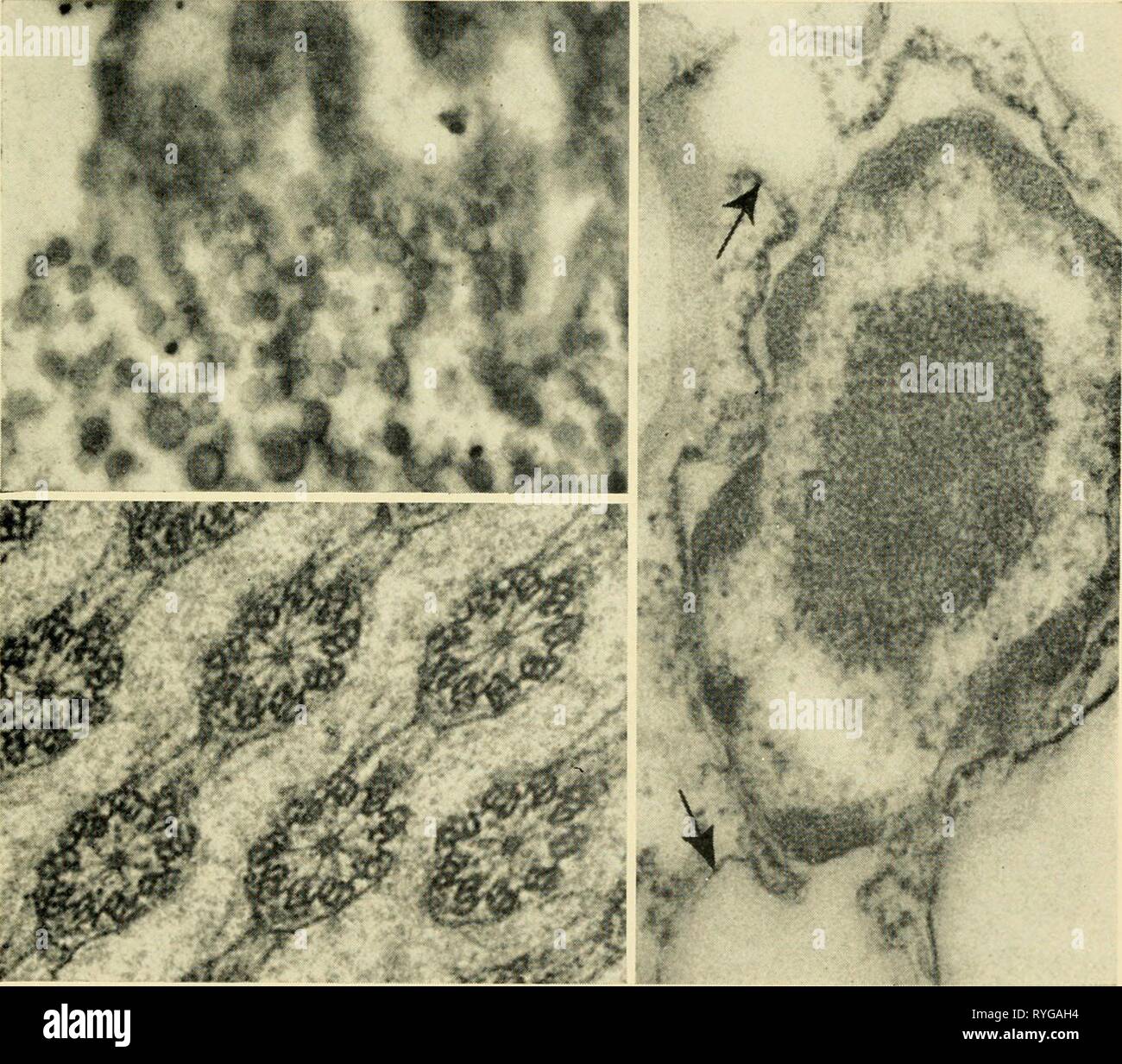 Elettron-struttura microscopica di protozoi electronmicrosco00pite Anno: 1963 14 15 I 16 Foto Stock