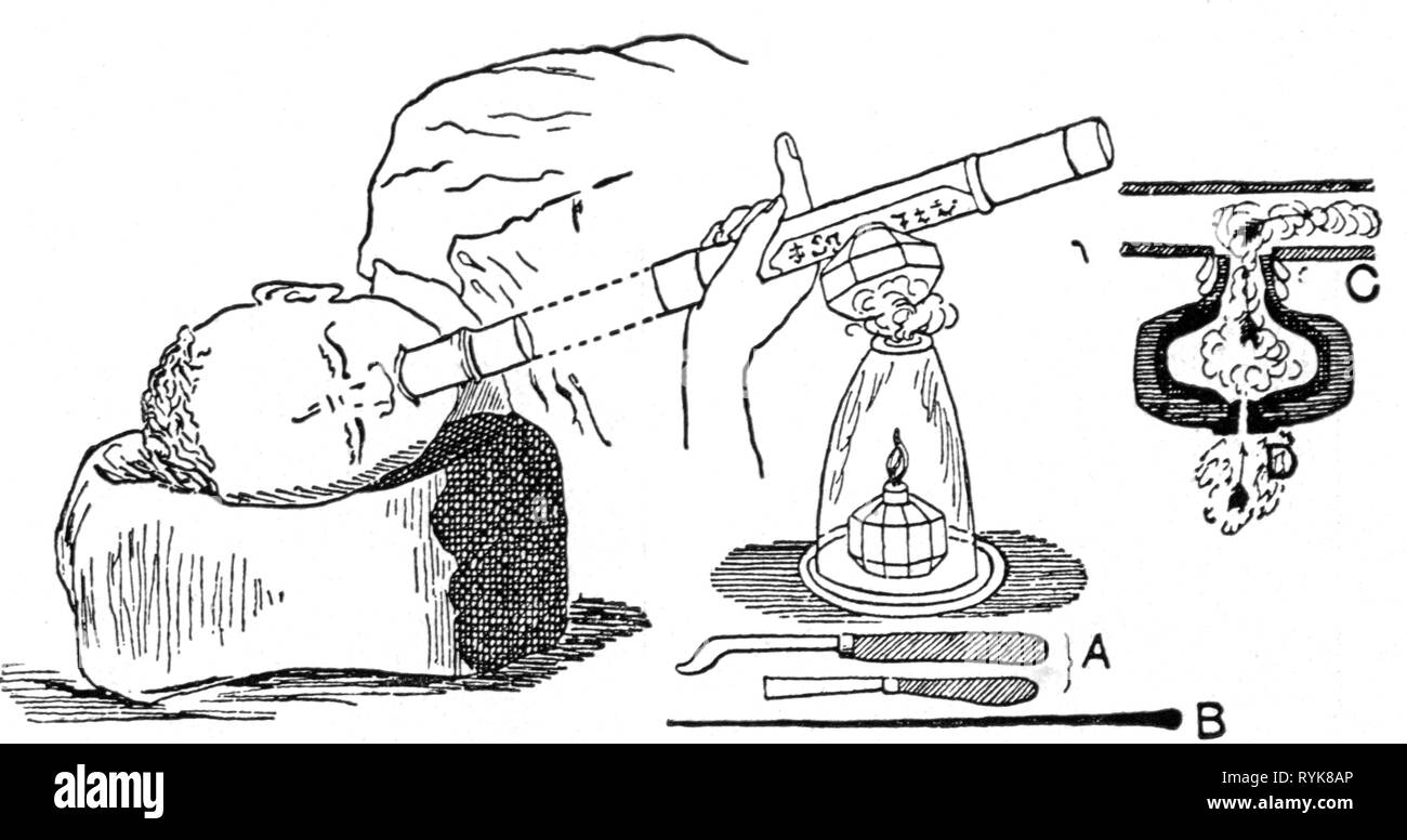 La droga, l'oppio, l'oppio fumatore si infiamma il suo tubo, strumenti A: coltello per imuovere oppio rimane, B: ago al posto di oppio, C: intersezione tra la testa di un tubo di oppio, disegno, la prima metà del XX secolo, droga, stupefacenti, DOPE, lampade, lampada di oppio, tubo di fumo, tubi, Kindle, accendi, facendo accendere la luce, illuminazione accesa, tossicodipendenza, tossicodipendenza, tossicodipendenti, fumatori, fumo, incendiare, incendiare, tool, strumenti, coltello, coltelli, rimozione rimozione, ago, aghi, luogo, installare, mount, testa, capi, storico, storico Additional-Rights-Clearance-Info-Not-Available Foto Stock