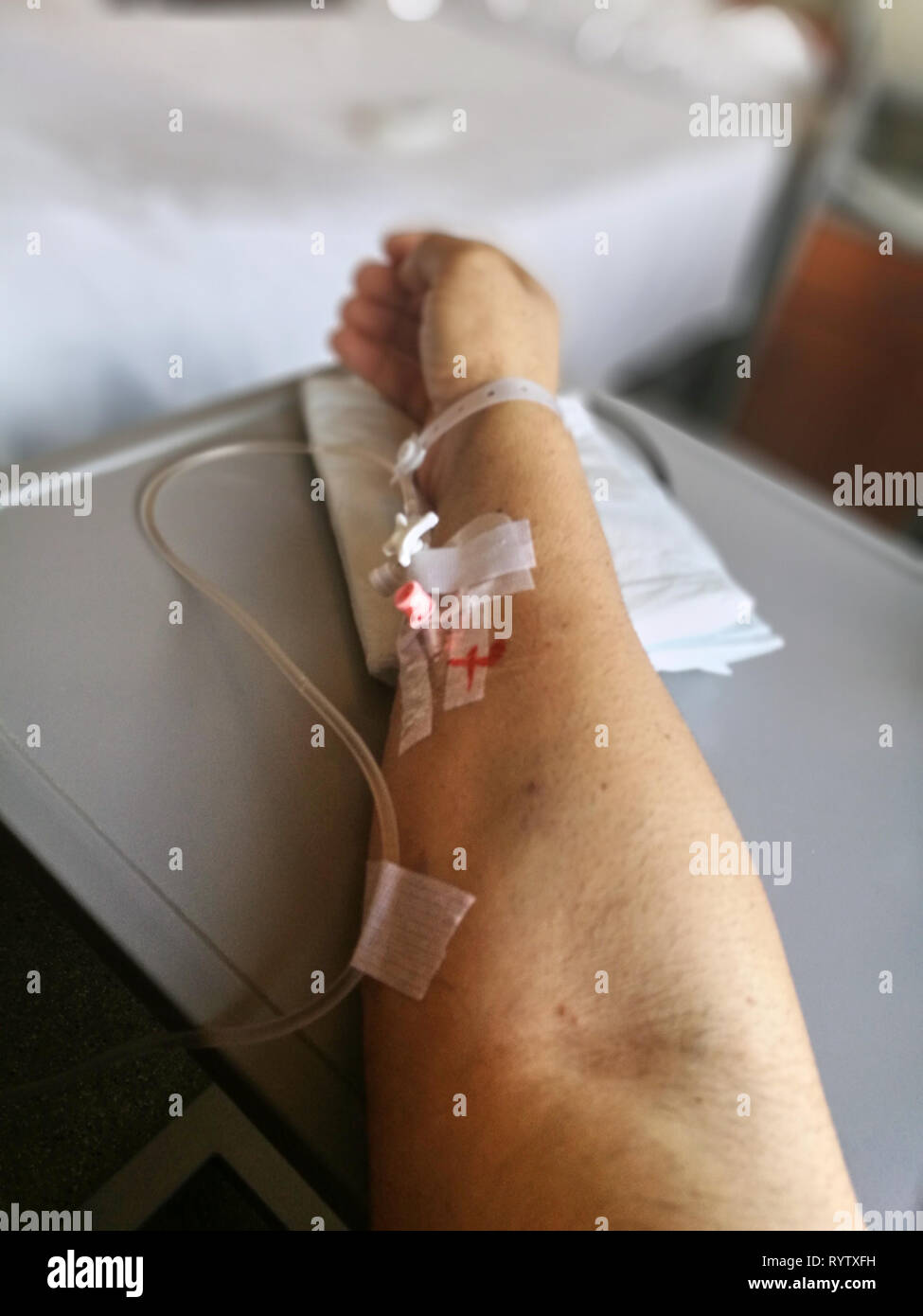 Primo piano di un braccio con periferiche catetere venoso Foto Stock