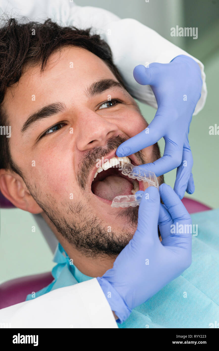 Ortodontista montaggio rinforzi invisibili. Foto Stock