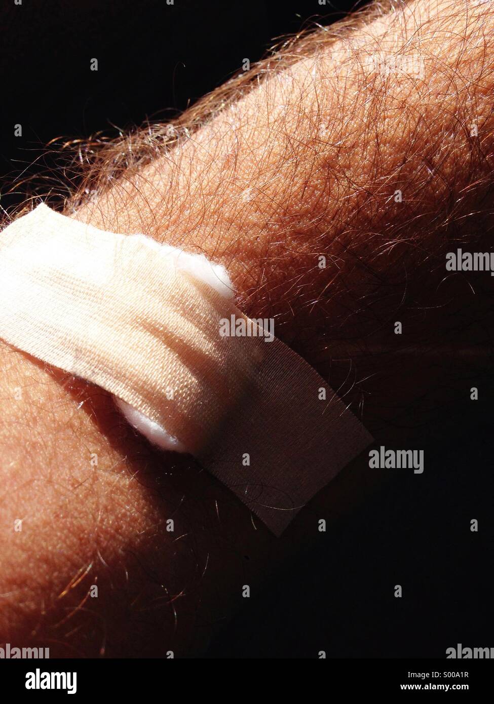 Tampone di cotone copre il gomito dopo il prelievo del sangue. - Immagine stock catturata con smartphone