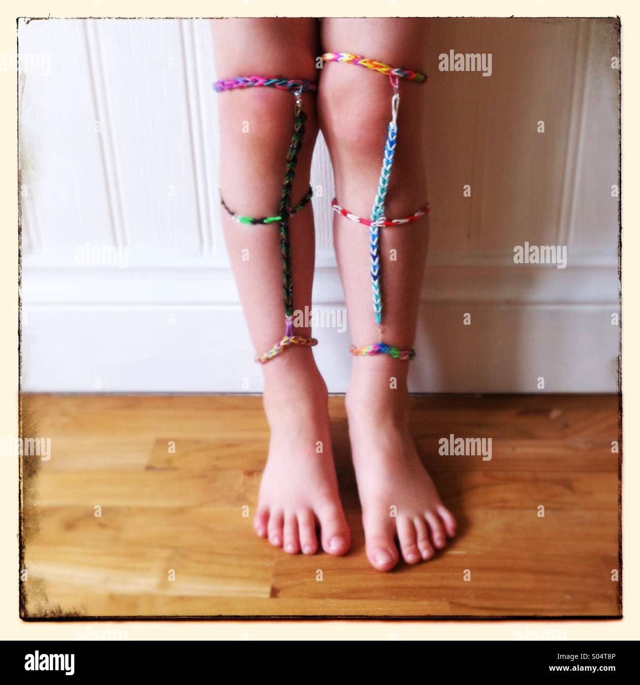 Telaio gambali bande su un kids gambe - Immagine stock catturata con smartphone