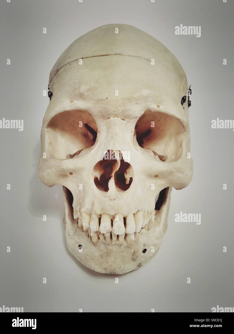 Cranio umano vista frontale Foto Stock
