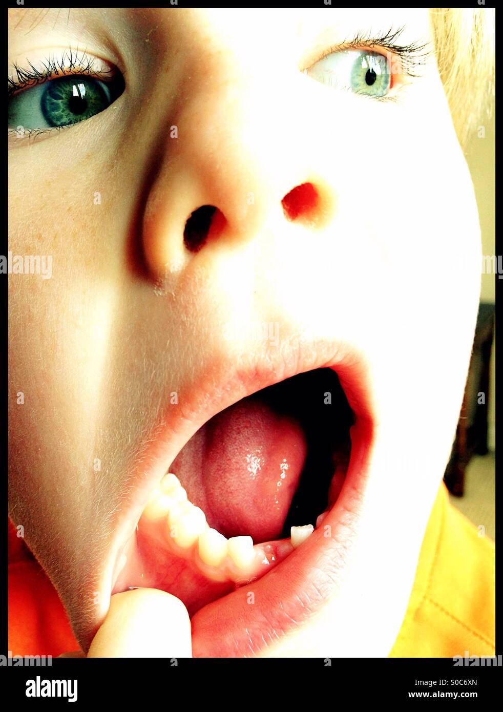 Primo bambino dente è caduto fuori. Foto Stock