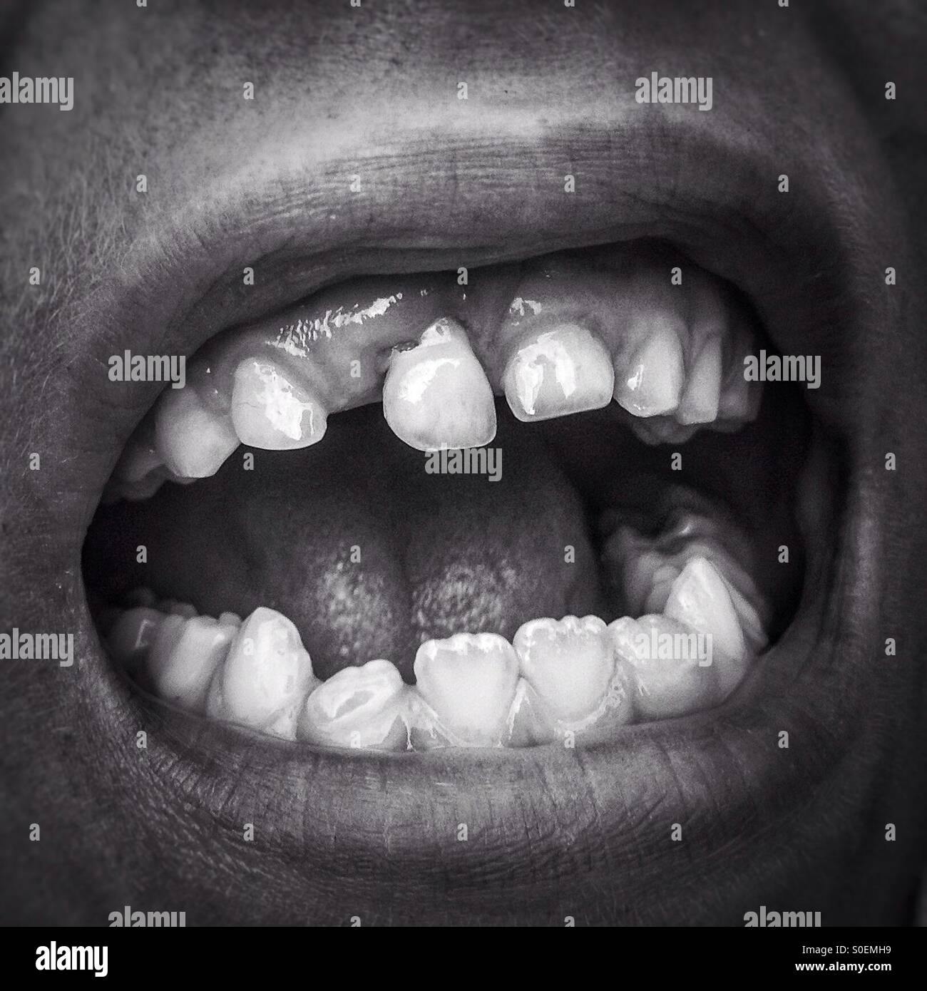 A bocca aperta con i denti di latte - Immagine stock catturata con smartphone