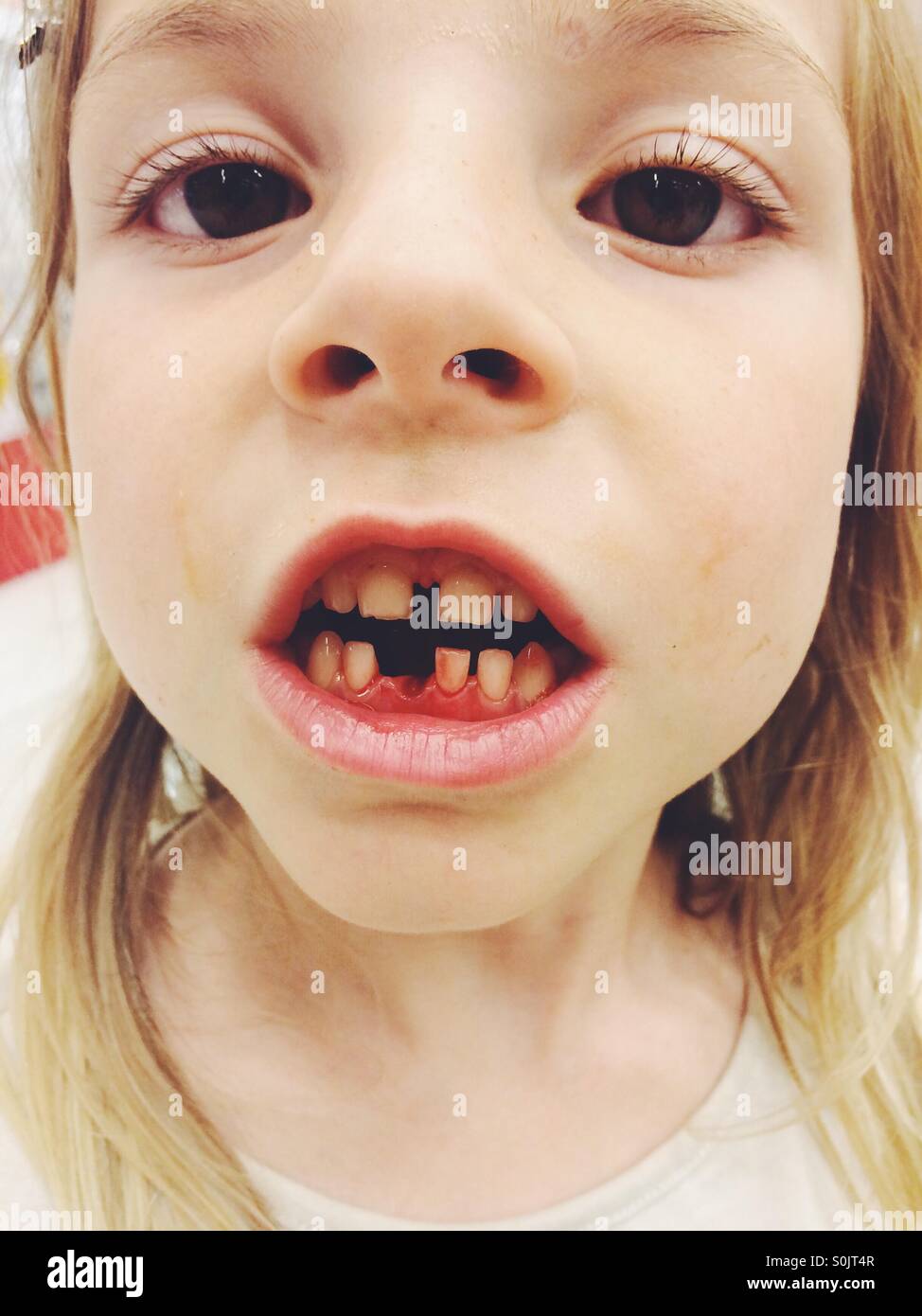 Bambina che ha appena perso il suo primo dente Foto Stock
