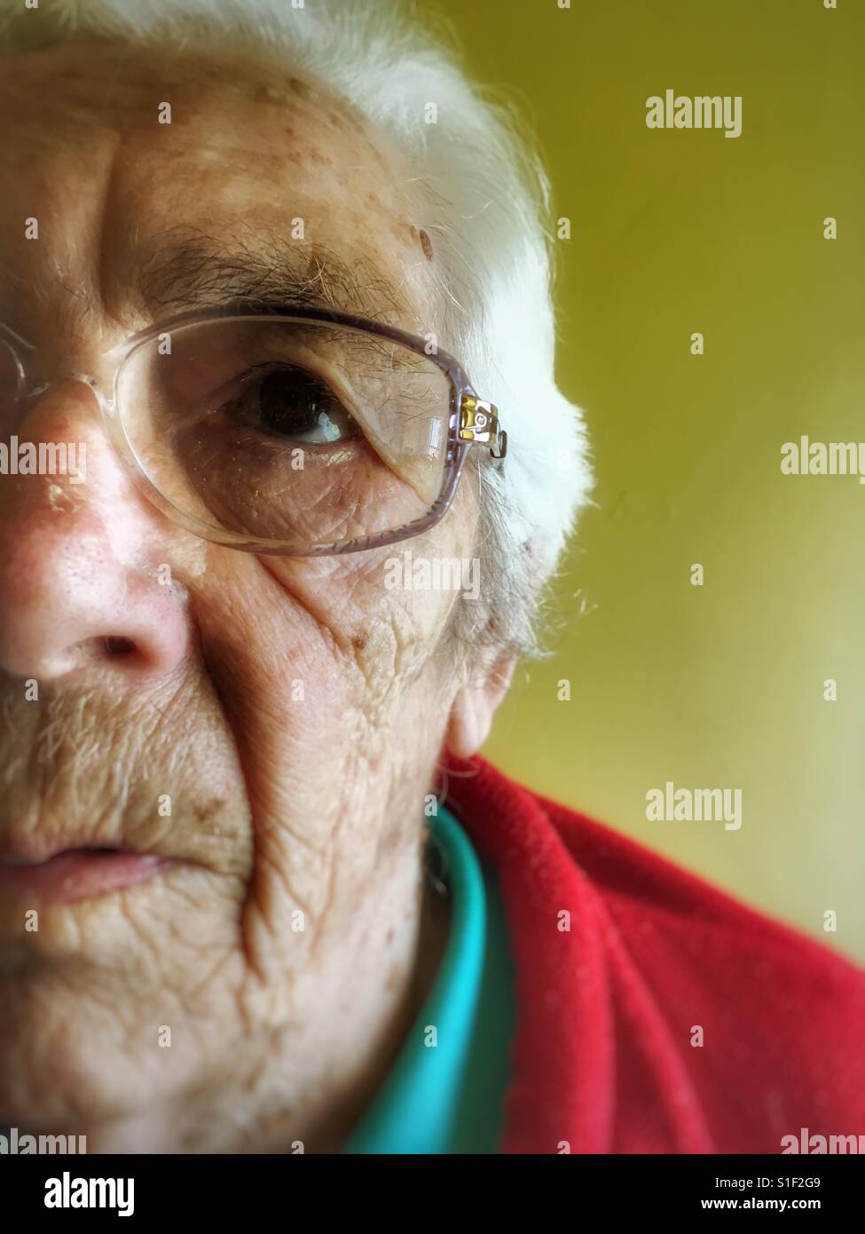 Donna anziana con degenerazione maculare nei suoi occhi Foto Stock