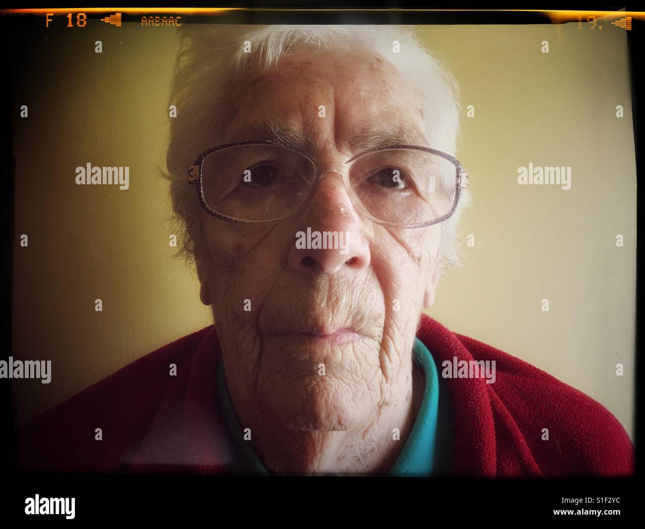 Donna anziana con degenerazione maculare nei suoi occhi Foto Stock