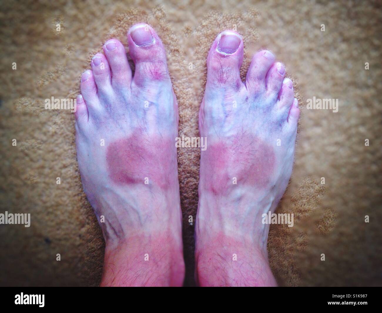 Piedi dal sole. Foto Stock