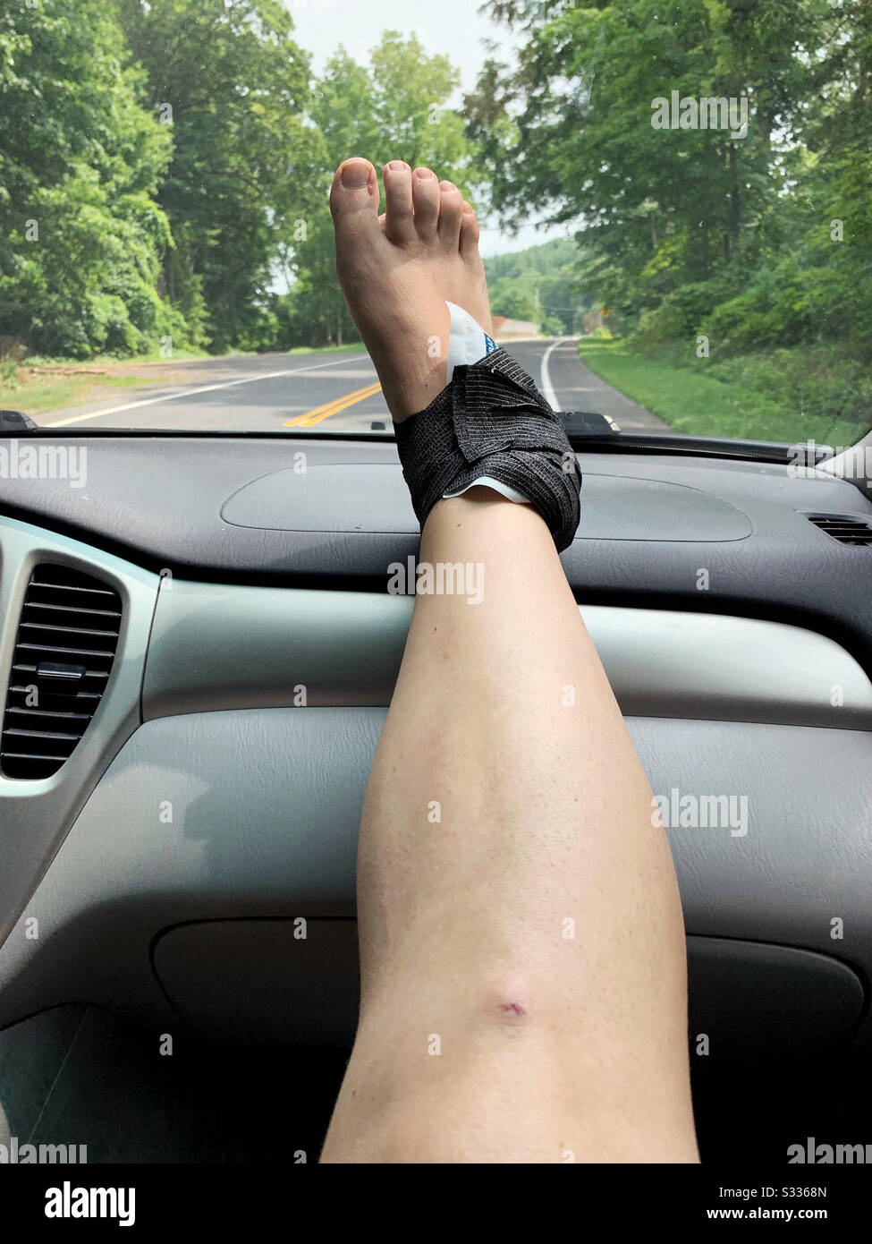 Lesioni alla caviglia e guida alla sala di emergenza, sprain della caviglia POV o rottura con il pacchetto del ghiaccio e bendaggio - Immagine stock catturata con smartphone