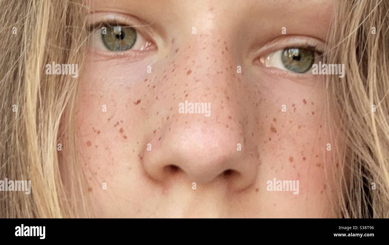 primo piano di una ragazza con le freckles e gli occhi verdi Foto Stock