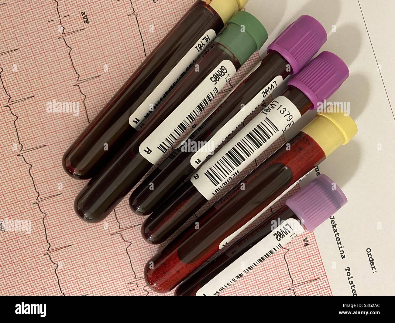 Fiale di sangue con tappi colorati e stampa EKG. - Immagine stock catturata con smartphone