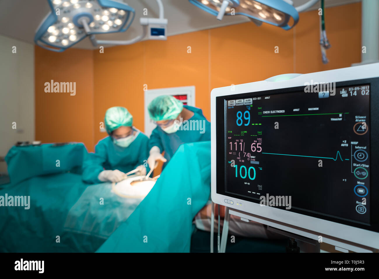 Monitor medicale con medico e un assistente in sala operatoria per chirurgia vascolare venosa clinica di chirurgia. Foto Stock