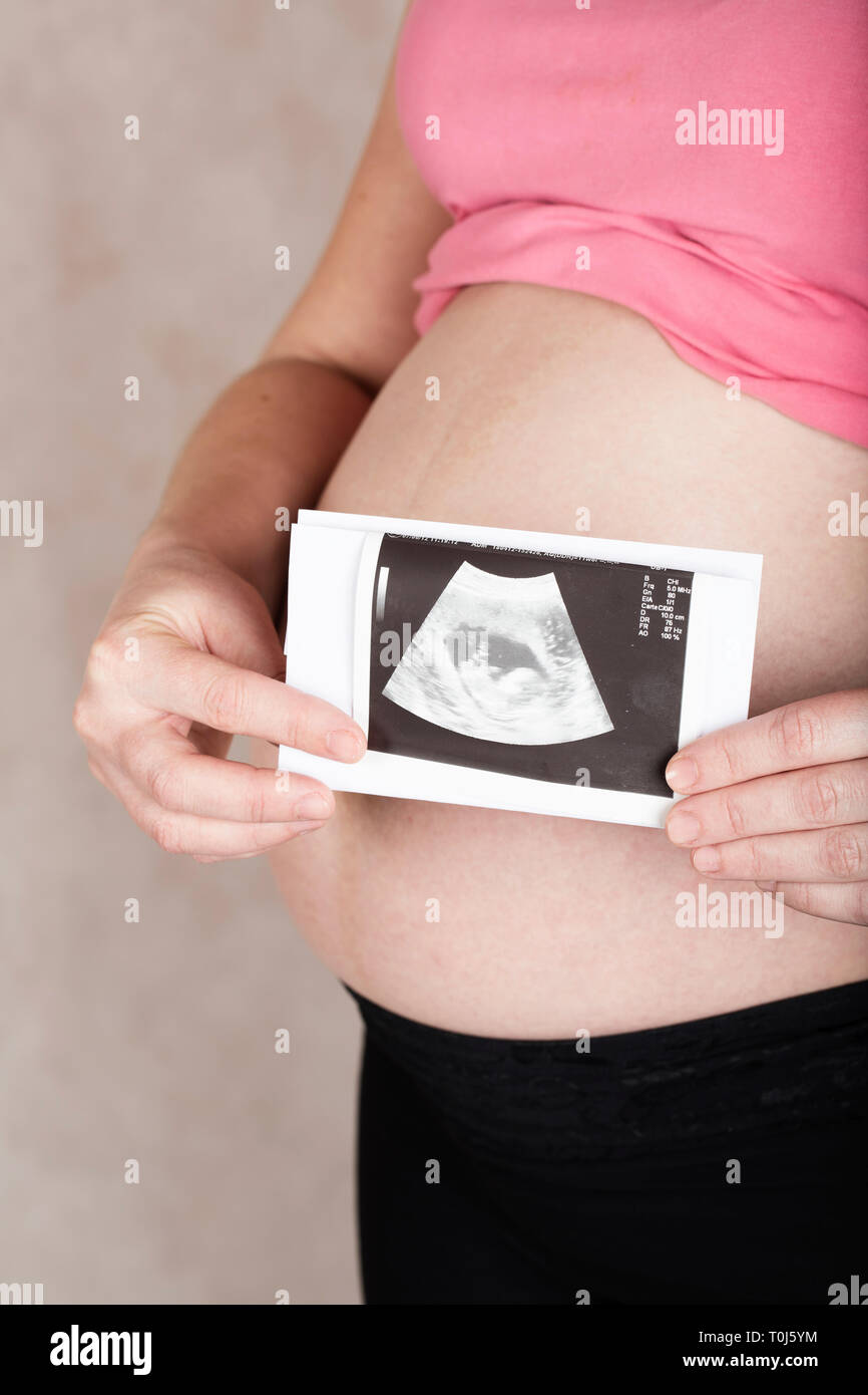 Gravidanza giovani tra i 30 e i 35 anni donna mantiene USG immagine del suo bambino. Primo piano Foto Stock