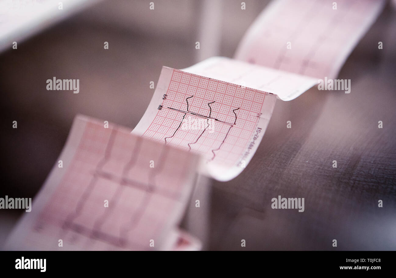 Medical cardiogram stampato su carta sul tavolo, inquietanti notizie circa la salute del cuore Foto Stock