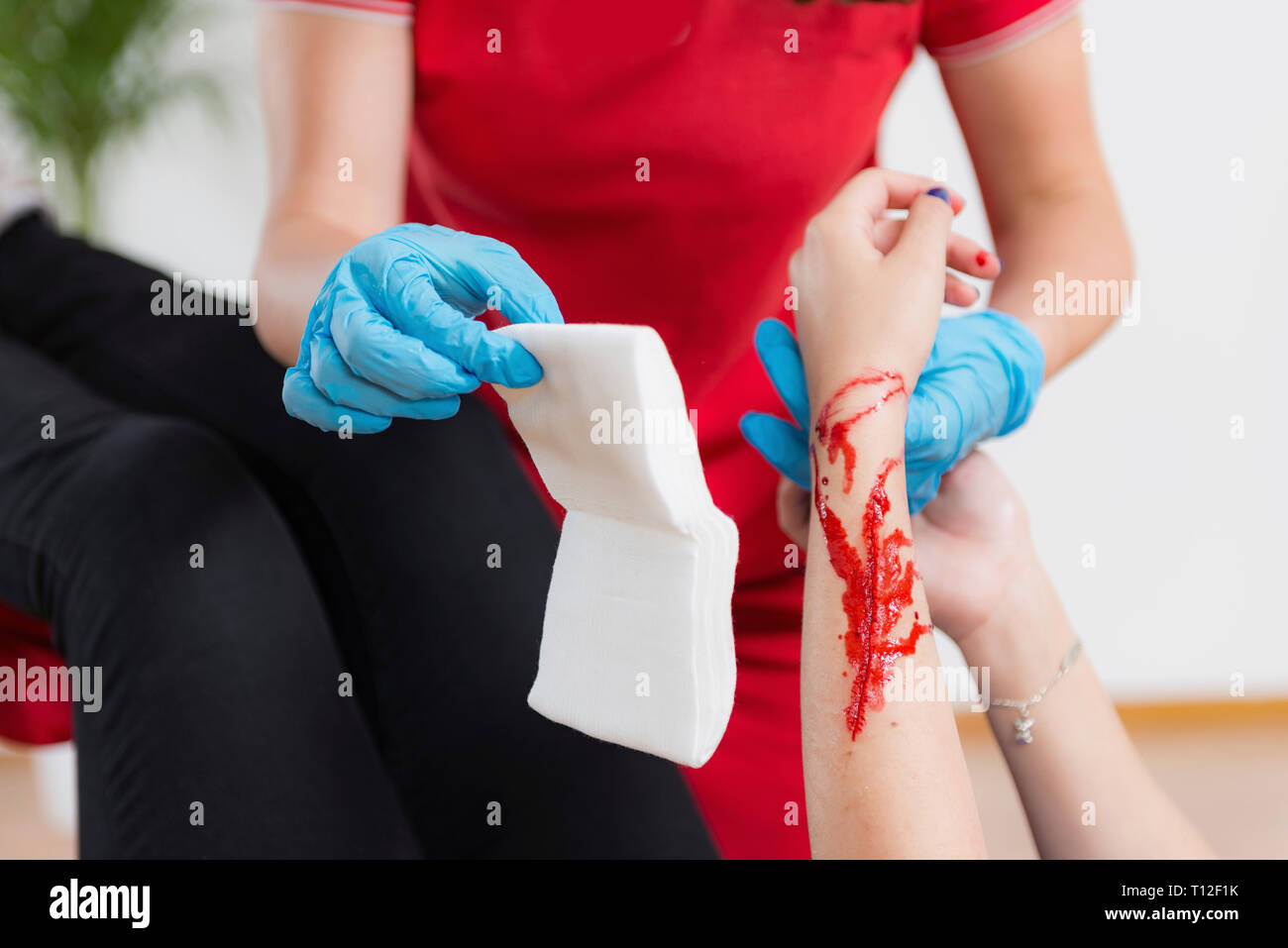 Formazione di primo soccorso. Ustioni. Corso di primo soccorso. Foto Stock