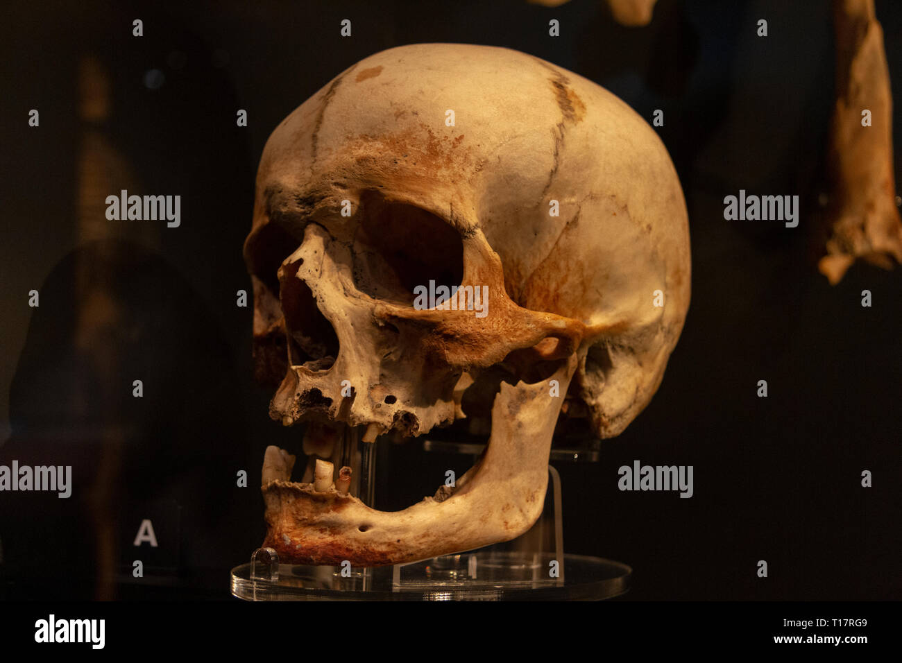Cranio di un Master Gunner (basato su oggetti trovati con lui) in Mary Rose Museum, Portsmouth Historic Dockyard, REGNO UNITO Foto Stock